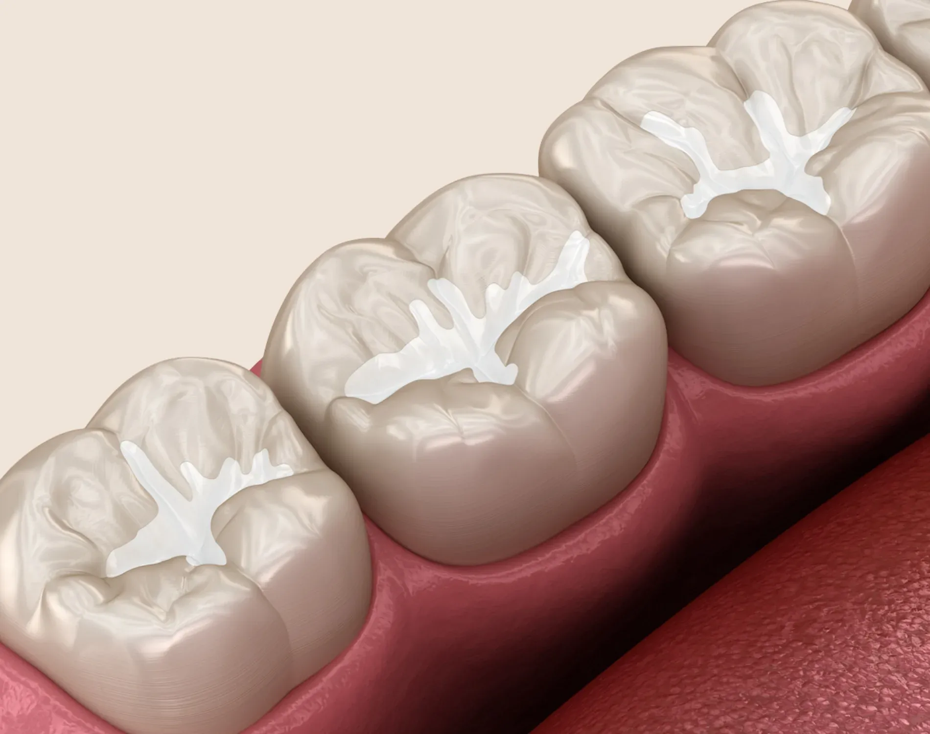 Sealants